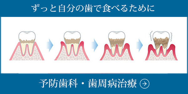 予防歯科と歯周病について